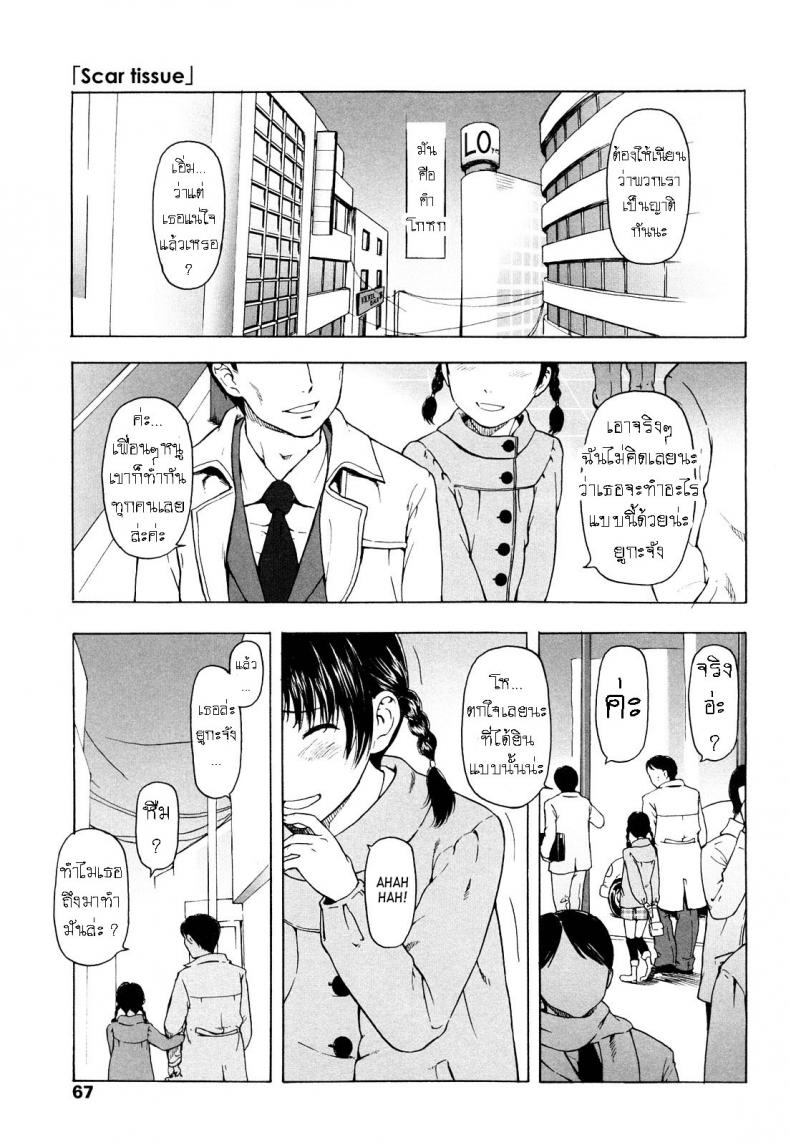 รอยแผลในใจ [Onizuka Naoshi] Scar Tissue – รอยแผลในใจ [Onizuka Naoshi] Scar Tissue หน้า 1